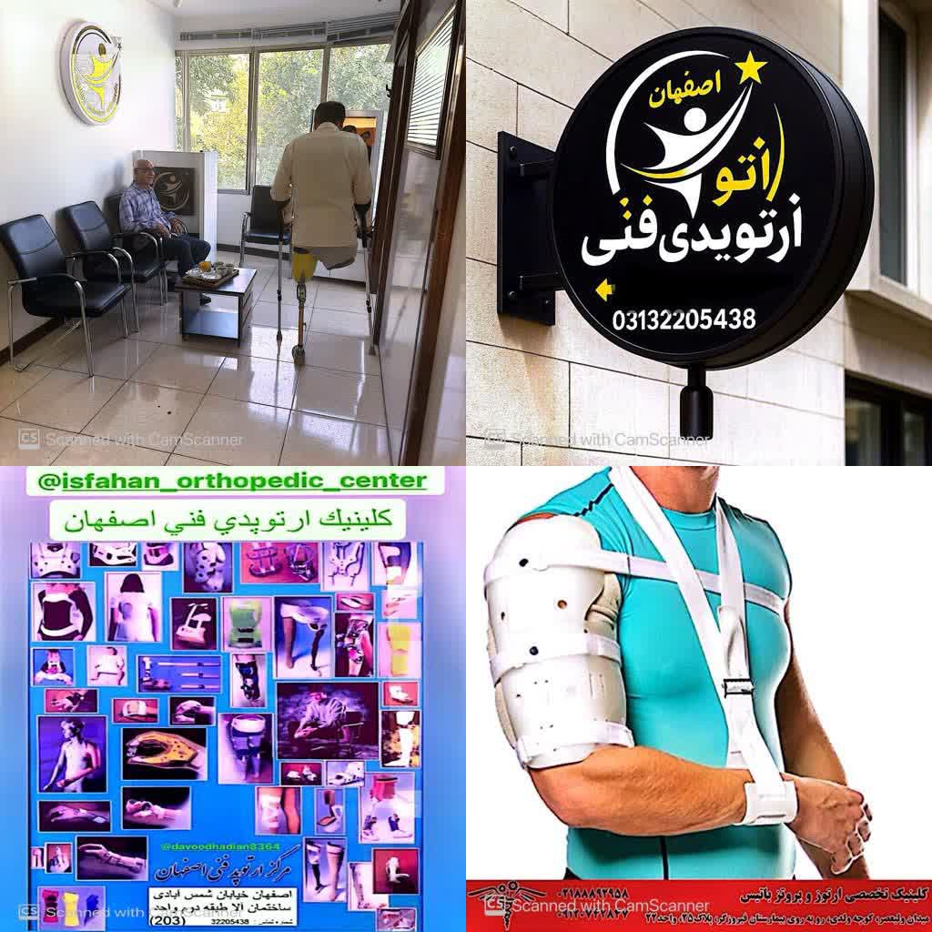 فنی